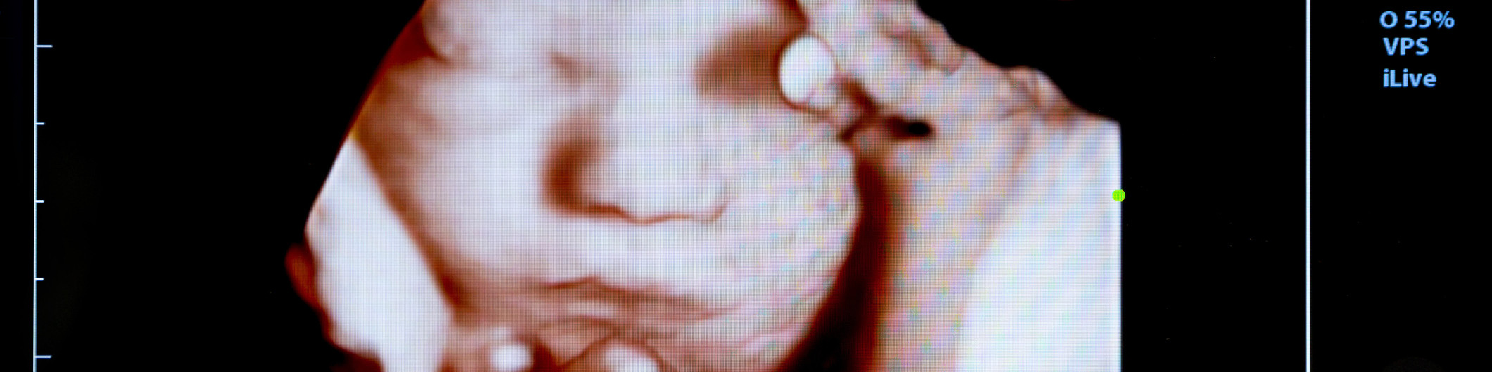  Baby-Ultraschall.jpg